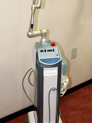 炭酸ガスレーザー