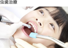 虫歯治療
