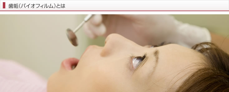 歯垢(バイオフィルム)とは