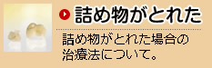 詰め物がとれた