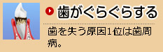 歯がぐらぐらする