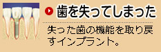 歯を失ってしまった