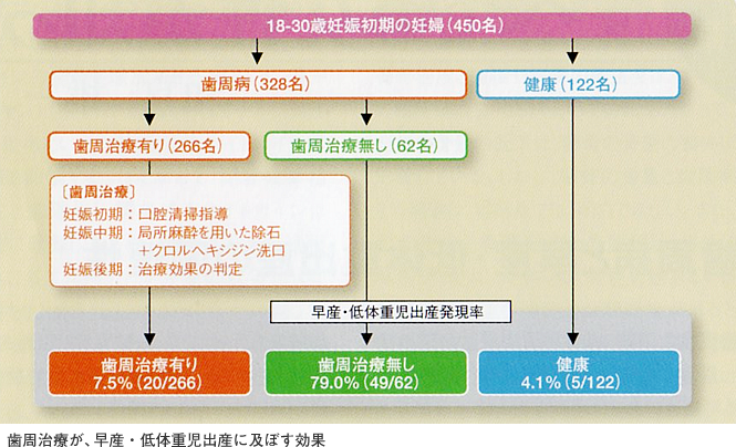 歯周治療が、早産・低体重児出産に及ぼす効果