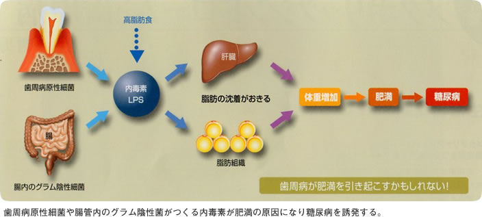 歯周病原性細菌や腸管内のグラム陰性菌がつくる内毒素が肥満の原因になり糖尿病を誘発する。