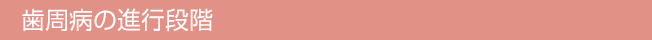 歯周病の進行段階