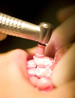 歯周病の治療方法